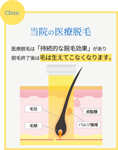 当院の医療脱毛