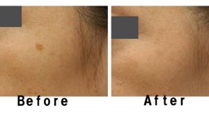 %e3%82%a2%e3%82%ad%e3%83%a5%e3%83%86%e3%82%a3%e3%83%83%e3%83%97%ef%bc%91