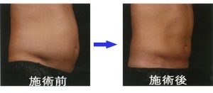 %e3%82%b9%e3%82%ab%e3%83%ab%e3%83%97%e3%82%b7%e3%83%a5%e3%82%a2%ef%bc%91