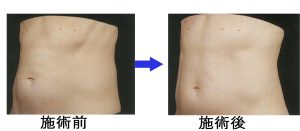 %e3%82%b9%e3%82%ab%e3%83%ab%e3%83%97%e3%82%b7%e3%83%a5%e3%82%a2%ef%bc%92