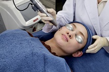 レーザートーニング1