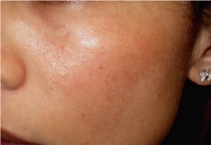 フラクショナルｂ