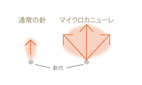 注入範囲の違い