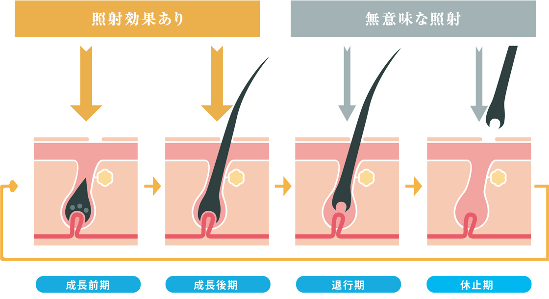 毛周期