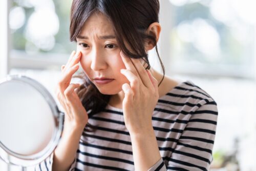 目の下のたるみはどうしてできるの?原因や予防方法を解説【高崎市・太田市・前橋市の目元のたるみ・くま】