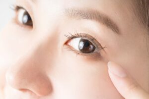 目もとのヒアルロン酸注入