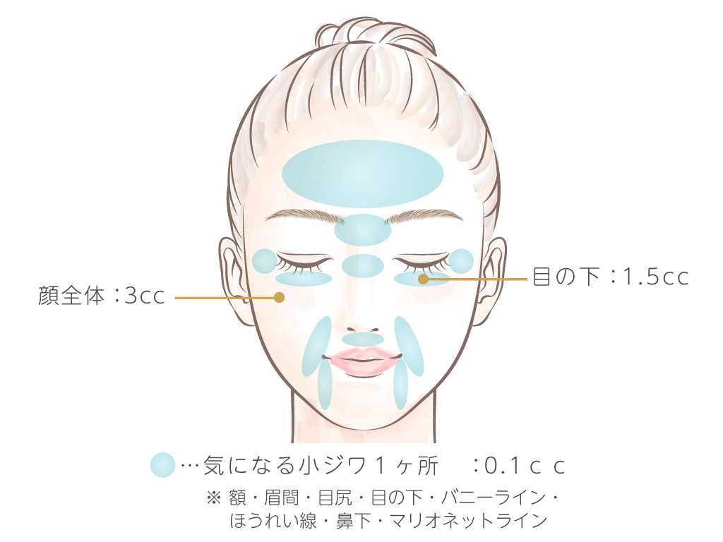 注入部位と目安量