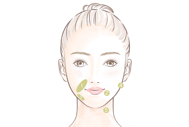 BNLS Ultimate注射　注射可能な部位