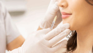 ヒアルロン酸注入