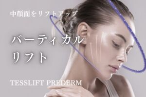 バーティカルリフト